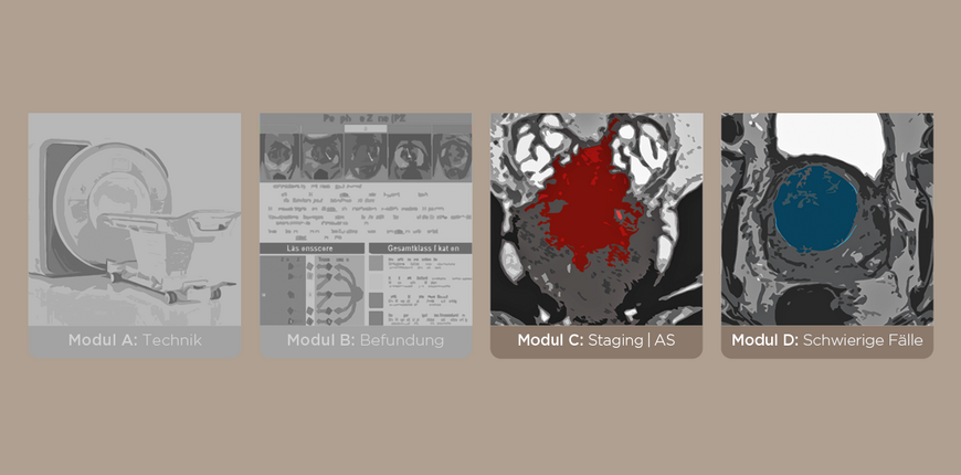 MR-Prostatographie Modul C (AS, Staging, Rezidiv) und Modul D (schwierige Fälle) Q2-Kurs - AUSGEBUCHT